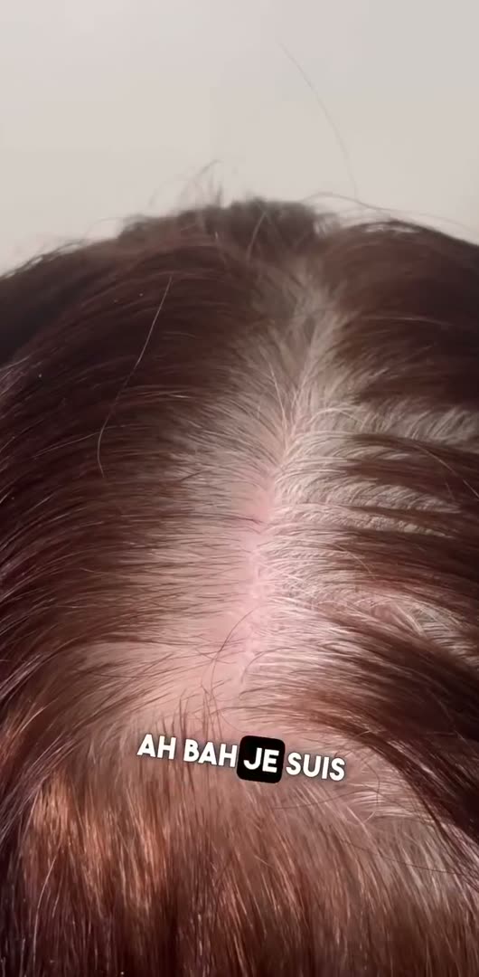 Avant, Couverture 100 % sur cheveux entièrement blancs